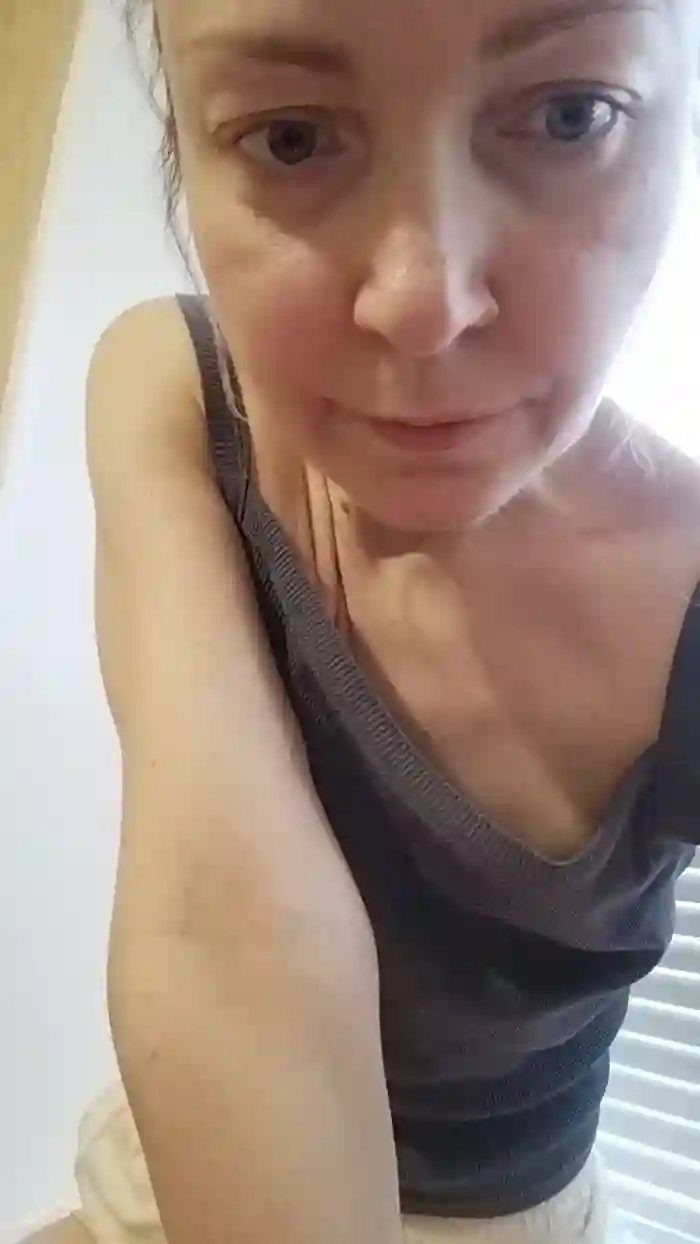MissDisare