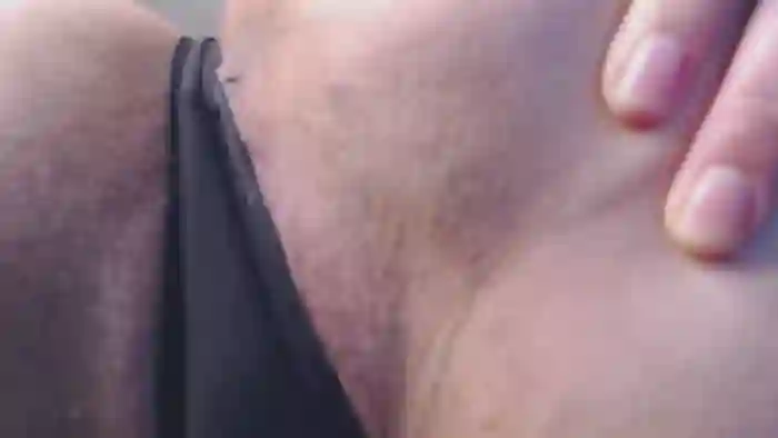 alycetn