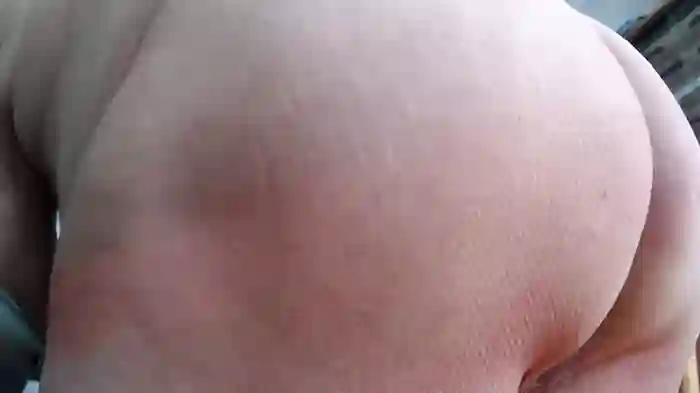utilisasinus