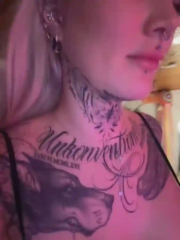 Stella-Kink